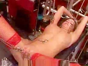 Bladder filling through catheter – FreePron.Org